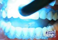 Blanqueamiento Dental + Limpieza Con Ultrasonido - Cordoba